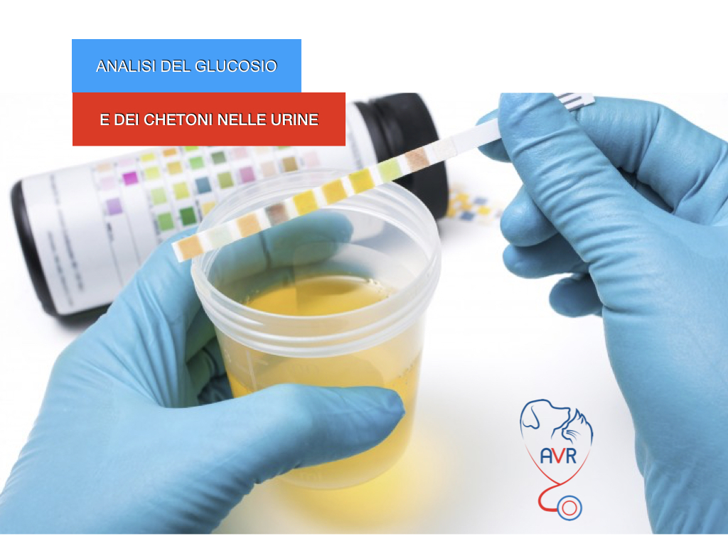 Analisi Del Glucosio E Dei Chetoni Nelle Urine